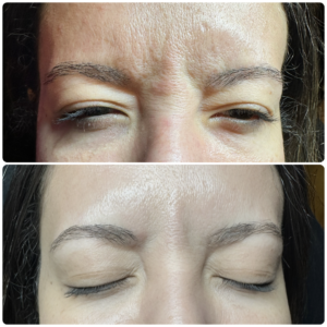 Before After Letybo